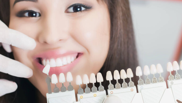 Lente de contato dental em Osasco é na Dentale Instituto Odontológico!