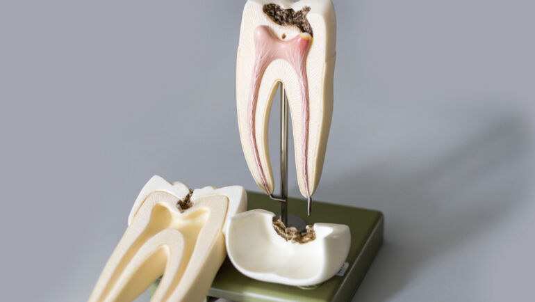 Endodontia é na Dentale Osasco